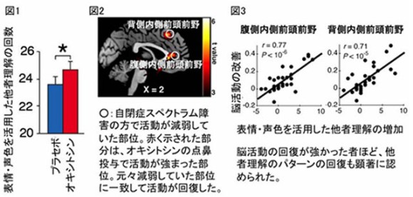 ab9afb0b%E3%82%AA%E3%82%AD%E3%82%B7%E3%83%88%E3%82%B7%E3%83%B3%EF%BC%92.jpg